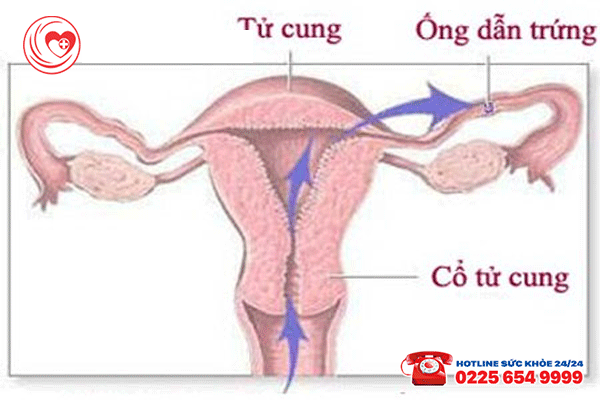 Đau bụng dưới âm ỉ - Lý giải điều gì ở nữ giới?