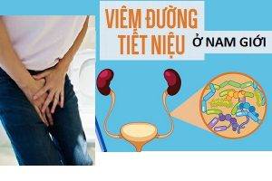 Viêm đường tiết niệu là bệnh gì?