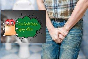 Lở loét bao quy đầu – Dấu hiệu báo động của nhiều bệnh lý