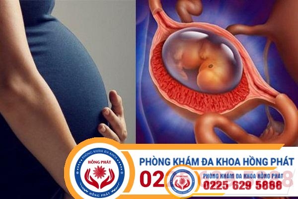 Phá thai ngoài tử cung như thế nào có nguy hiểm không?