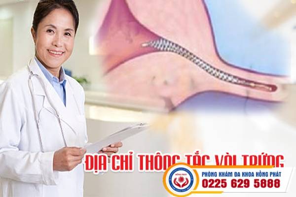 Địa chỉ thông tắc vòi trứng tại TP. Hải Phòng