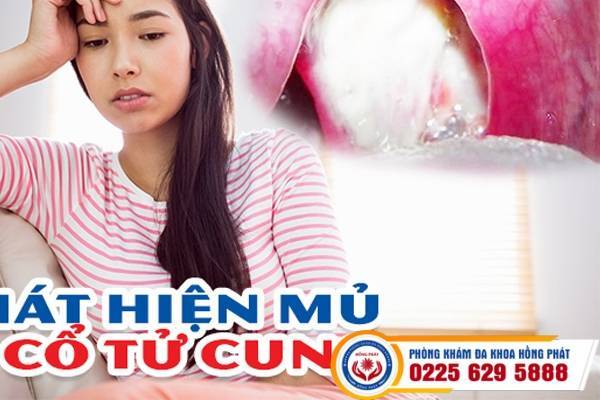 Phát hiện có mủ từ cổ tử cung, chị em nên làm gì?