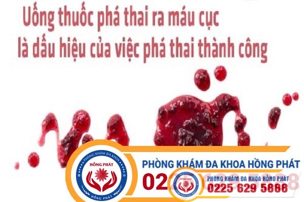 Phá thai ra máu cục có sao không bao lâu thì chấm dứt?