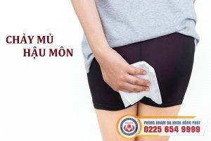 Chảy mủ hậu môn là dấu hiệu bệnh gì?