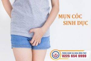 Điều trị mụn cóc sinh dục như thế nào hiệu quả?