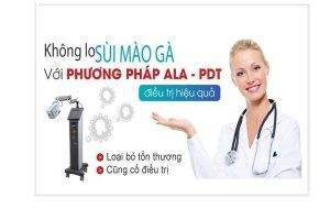 Giải pháp mới điều trị sùi ở vùng kín hiệu quả