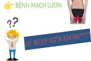 Bệnh mạch lương có nguy hiểm không?