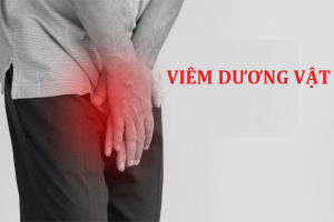 Viêm dương vật căn bệnh nguy hiểm cho nam giới