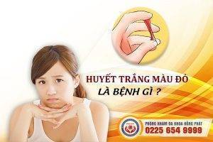 Huyết trắng màu đỏ dấu hiệu bệnh lý nguy hiểm