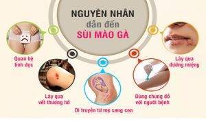 Nguyên nhân và triệu chứng sùi mồng gà