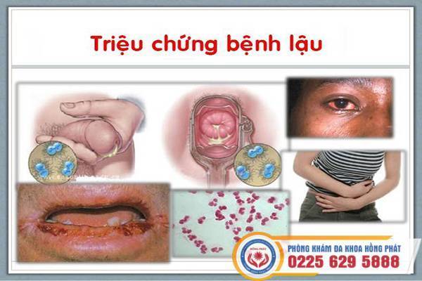 benh-lau-man-tinh