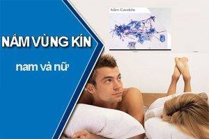 Dấu hiệu nhận biết bệnh nấm vùng kín