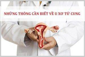 Thông tin cần biết về bệnh u xơ tử cung