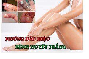 Bệnh huyết trắng có nguy hiểm không?