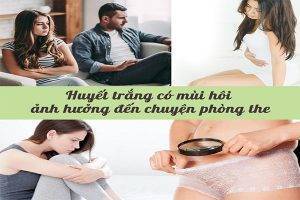 Huyết trắng có mùi là dấu hiệu bệnh lý gì?