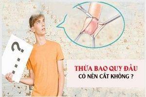 Thừa bao quy đầu có nên cắt không?