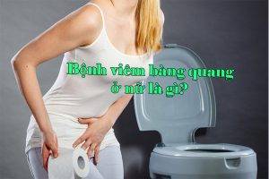 Bệnh viêm bàng quang ở nữ là gì?