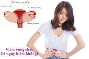 Triệu chứng bệnh viêm vùng chậu và cách điều trị