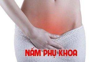 Điều trị nấm phụ khoa như thế nào hiệu quả?