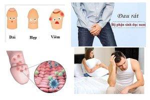 Các bệnh dương vật thường gặp hiện nay