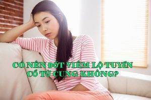 Có nên thực hiện đốt viêm lộ tuyến cổ tử cung không?