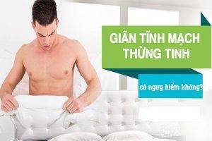 Giãn tĩnh mạch thừng tinh và những điều cần biết