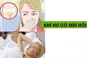 Phương pháp điều trị khí hư có mùi hôi hiệu quả là gì?