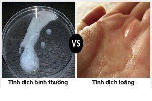 Cách kiểm tra chất lượng tinh trùng