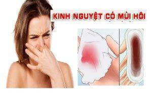 Kinh nguyệt có mùi hôi là bị bệnh gì?