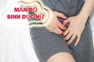 Triệu chứng mẩn đỏ sinh dục nữ là bị bệnh gì?