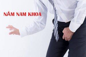 Nấm nam khoa và cách điều trị hiệu quả