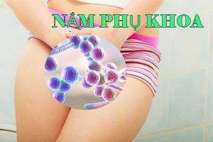 Dấu hiệu nhận biết bệnh nấm phụ khoa