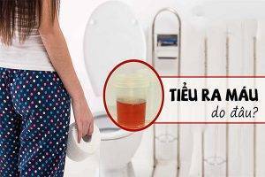 Tiểu ra máu là triệu chứng của bệnh gì?