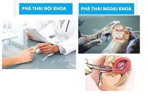 Phương pháp nạo hút thai an toàn tại phòng khám Hồng Phát