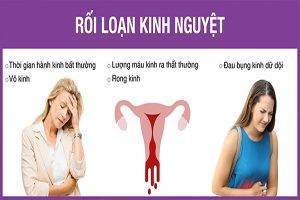 Biểu hiện rối loạn kinh nguyệt ở nữ giới