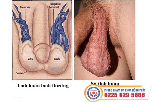 Khám chữa xuất tinh sớm tại Phòng Khám Đa Khoa Đạ