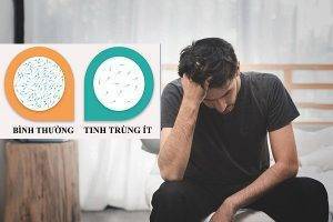 Tinh trùng ít làm thế nào để cải thiện chất lượng?