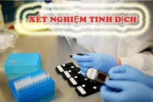 Xét nghiệm tinh dịch ở đâu uy tín tại Hải Phòng?