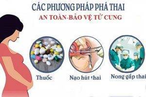 Lưu ý chuẩn bị trước khi phá thai