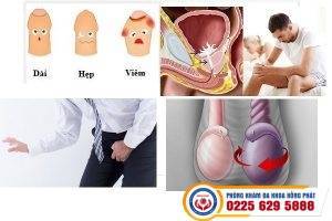 Bệnh dương vật chữa ra sao- điều trị tại đâu tốt ở Hải Phòng?