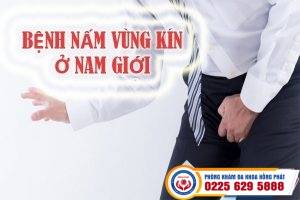 Tại sao vùng kín nam lại bị nấm – điều trị dứt điểm tại đâu?