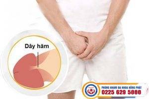 Đứt dây hãm bao quy đầu nguy hiểm không – Phải làm gì?