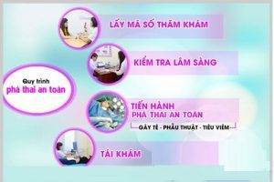 Quy trình phá thai – về trong ngày