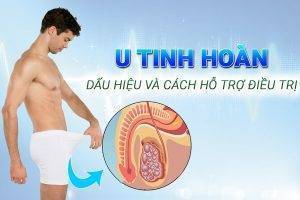 U tinh hoàn là gì – chữa trị ra sao- khám chữa dứt điểm tại Hải Phòng