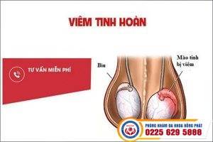 Các bệnh tinh hoàn thường gặp – phương pháp điều trị hiệu quả tại Nam khoa Hồng Phát