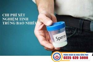 Chi Phí Xét Nghiệm Tinh Trùng Là Bao Nhiêu – Bảng Giá Mới Nhất