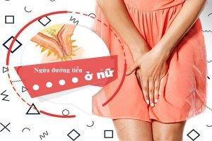 Ngứa đường tiểu ở nữ – Dấu hiệu không nên bỏ qua