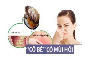 Âm đạo có mùi hôi khó chịu là dấu hiệu của bệnh gì?