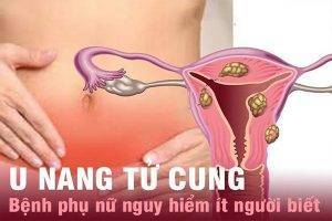 Bệnh lý về nang ở tử cung và các biến chứng nguy hiểm