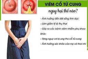 Địa chỉ và chi phí chữa viêm cổ tử cung